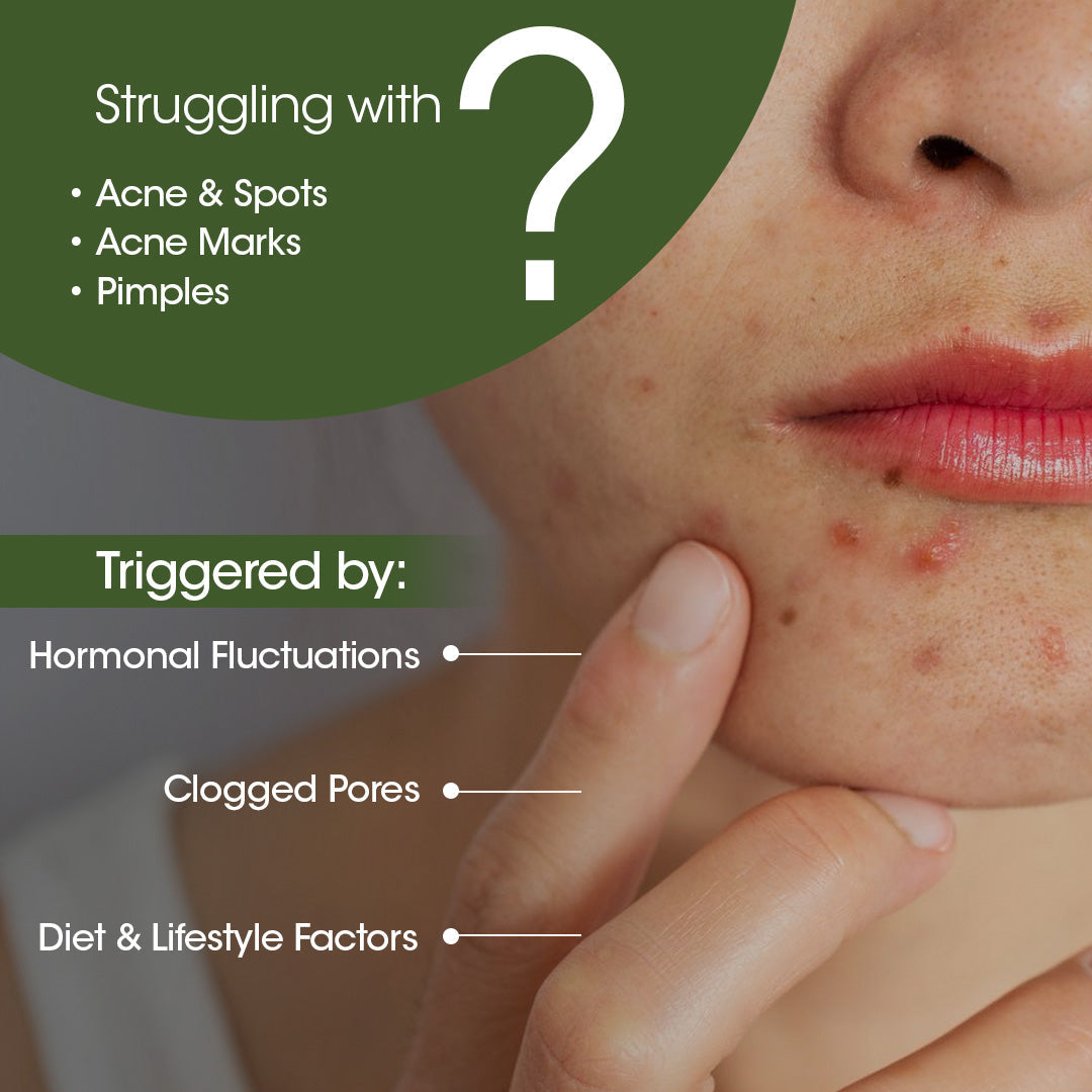 LAXAST Eladi Acne Control Combo