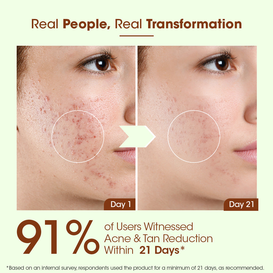 LAXAST Eladi Acne Control Combo