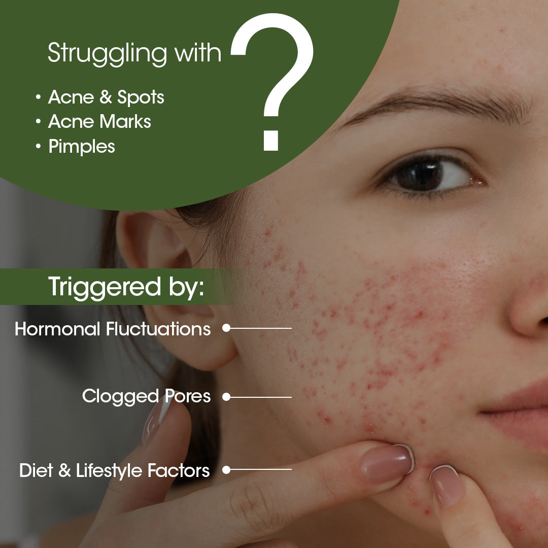 Acne & Spot Correction Face Serum