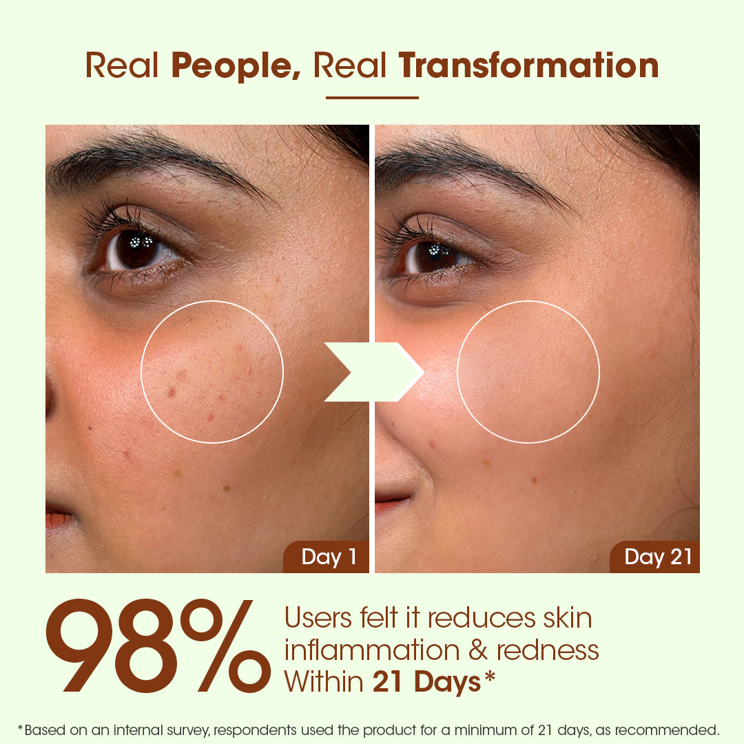 Acne & Spot Correction Face Serum