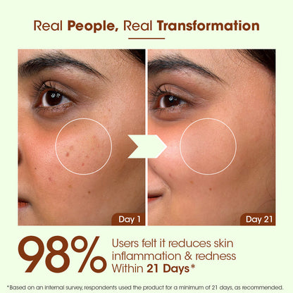 Acne & Spot Correction Face Serum